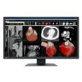 Eizo Radiforce MX317W